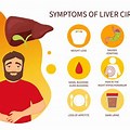 Signs and Symptoms of Liver Disease