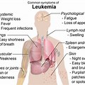 Symptoms of Acute Leukemia