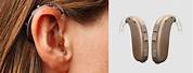 BTE and Customized Hearing Aids