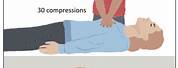 CPR Adult Ventilation
