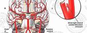 Carotid Artery Brain Aneurysm Repair