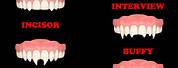 Different Types of Vampire Fangs