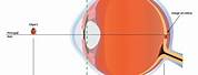 Focal Length of Human Eye
