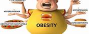 Types of Diet in Obesity