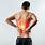 Acute Lower Back Pain