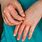 Allergy Skin Rash On Hands