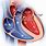 Aortic Heart Valve