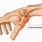 Base of Thumb Joint Arthritis