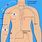 Central Venous PICC Line