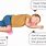 Child Recovery Position