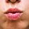 Extremely Dry Lips