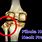 Fibular Neck Fracture