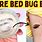 Get Rid of Bed Bug Bites Fast