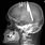 Head Injury X-ray