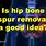 Hip Bone Spurs Treatment