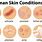 Human Skin Conditions