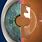 ICL Refractive Surgery