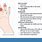 Index Finger Knuckle Joint Pain