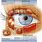Inner Eyelid Lesion