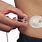Insulin Pump Infusion Sets