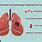 Lung Cancer Immunotherapy