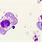 Mesothelial Cells