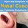 Nasal Cancer Stages