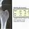 Normal Bone Density Scan