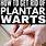 Plantar Wart Treatment