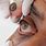 Prosthetic Eye