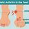 Psoriatic Arthritis Foot