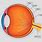 Retina and Choroid