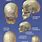 Skull Bones and Sutures