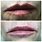 Smokers Lips Before and After