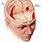 Traumatic Brain Injury Anatomy