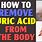 Uric Acid Removal