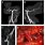Vertebral Artery Fenestration