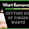 Wart Removal Methods