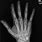 X-ray of Human Hand