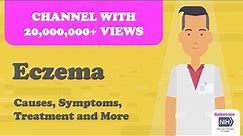 Eczema - Causes, Symptoms, Treatment and More