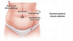 An Approach to Acute Abdominal Pain