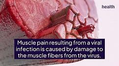Is Muscle Pain a Symptom of COVID-19?