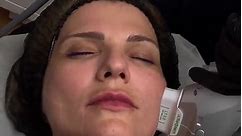 SMAS lifting treatment is indicated for: ✔️ restoration of clarity of the oval face; ✔️ smoothing of nasolabial folds; ✔️ skin tightening in the area around the eyes, forehead, cheeks, neck, eyebrows ✔️ removal of the second chin Also, SMAS lifting is effective for the prevention of age-related changes, slowing down the signs of aging, improving the quality and relief of the skin. Want to create your own transformation story? Book your #SMASLifting appointment with us today! ••••••••••••••••••••