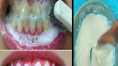 Get white teeth forever - Teeth whitening naturally at home #teethwhitening #whiteteeth | Simple Home Remedies