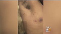 Plum Police To Interview Witnesses After Football Player Allegedly Assaulted By Coach