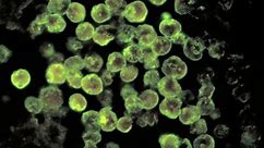 Brain-eating amoeba death in Georgia