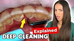 Dental Hygienist Explains Deep Cleaning Procedure