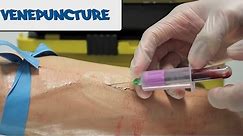 Venipuncture - How to take Blood - OSCE Guide (old version) | UKMLA | CPSA