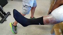 Knee and Ankle Ice Bag Application