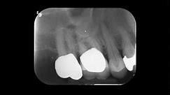 FMS Radiographic Interpretation for Dental School
